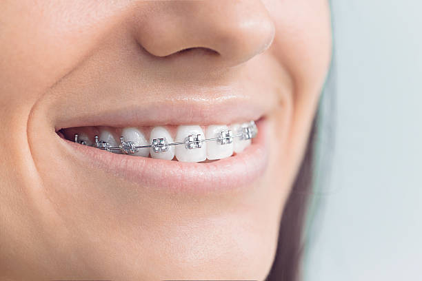 Best Veneers and Lumineers  in West End, NY